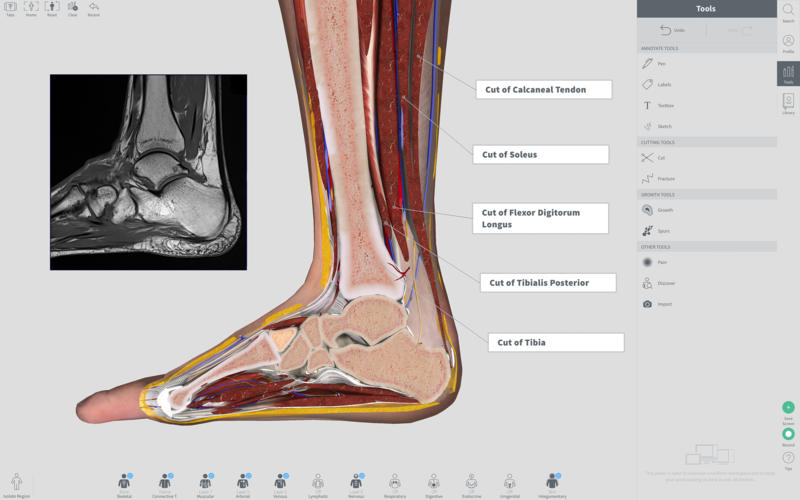 Complete Anatomy 2019 4.0.1 Mac 破解版 – 强大的3D医学人体模型