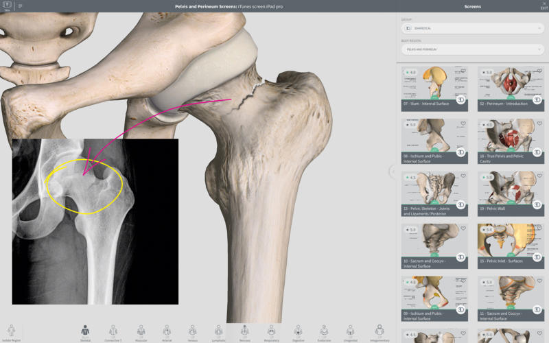 Complete Anatomy 2019 4.0.1 Mac 破解版 – 强大的3D医学人体模型-日主题 Complete Anatomy 2019 4.0.1 Mac 破解版 – 强大的3D医学人体模型